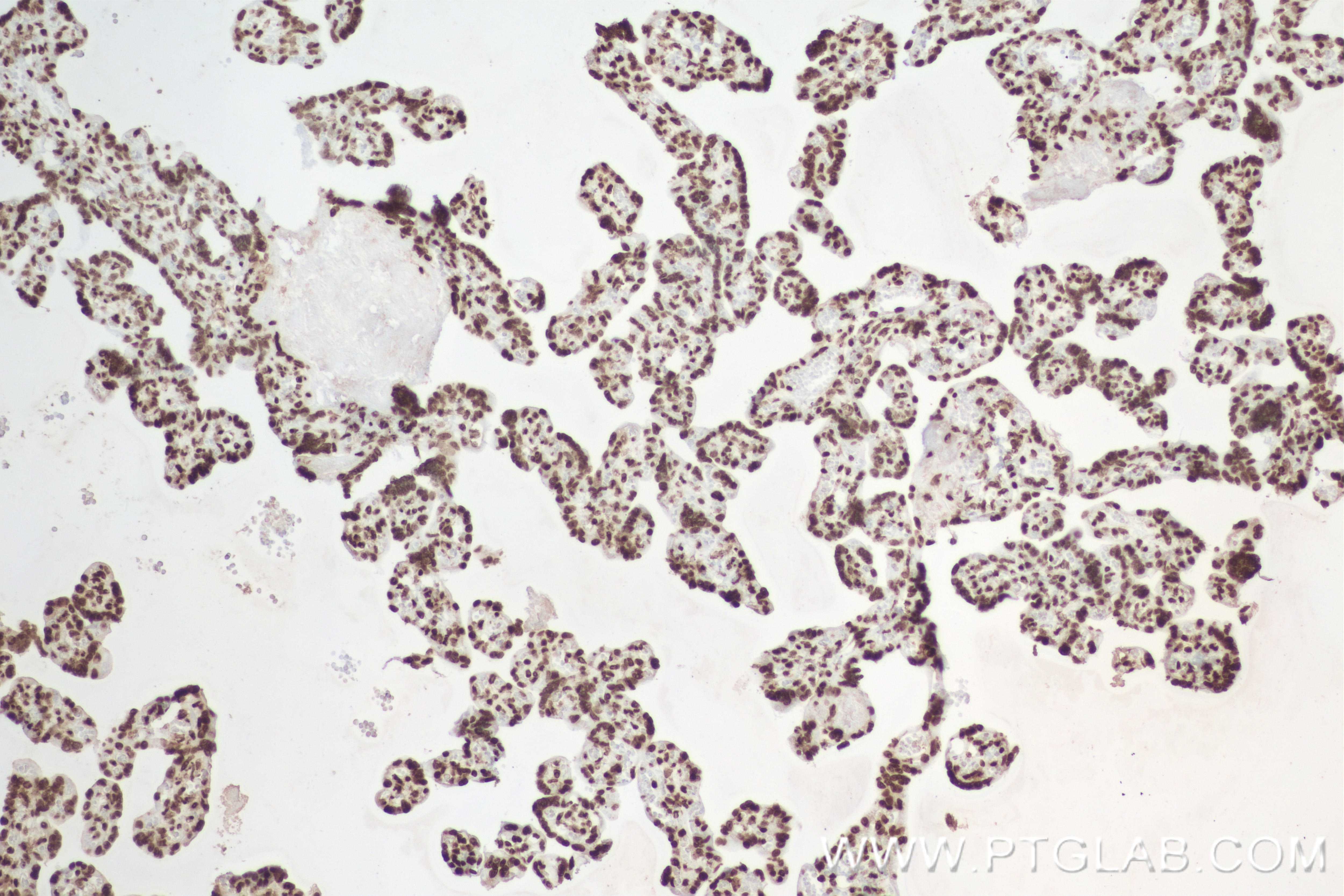 Immunohistochemistry (IHC) staining of human placenta tissue using Mono/Di/Tri-Methyl-Histone H3 (Lys4) Recombinant a (84908-1-RR)