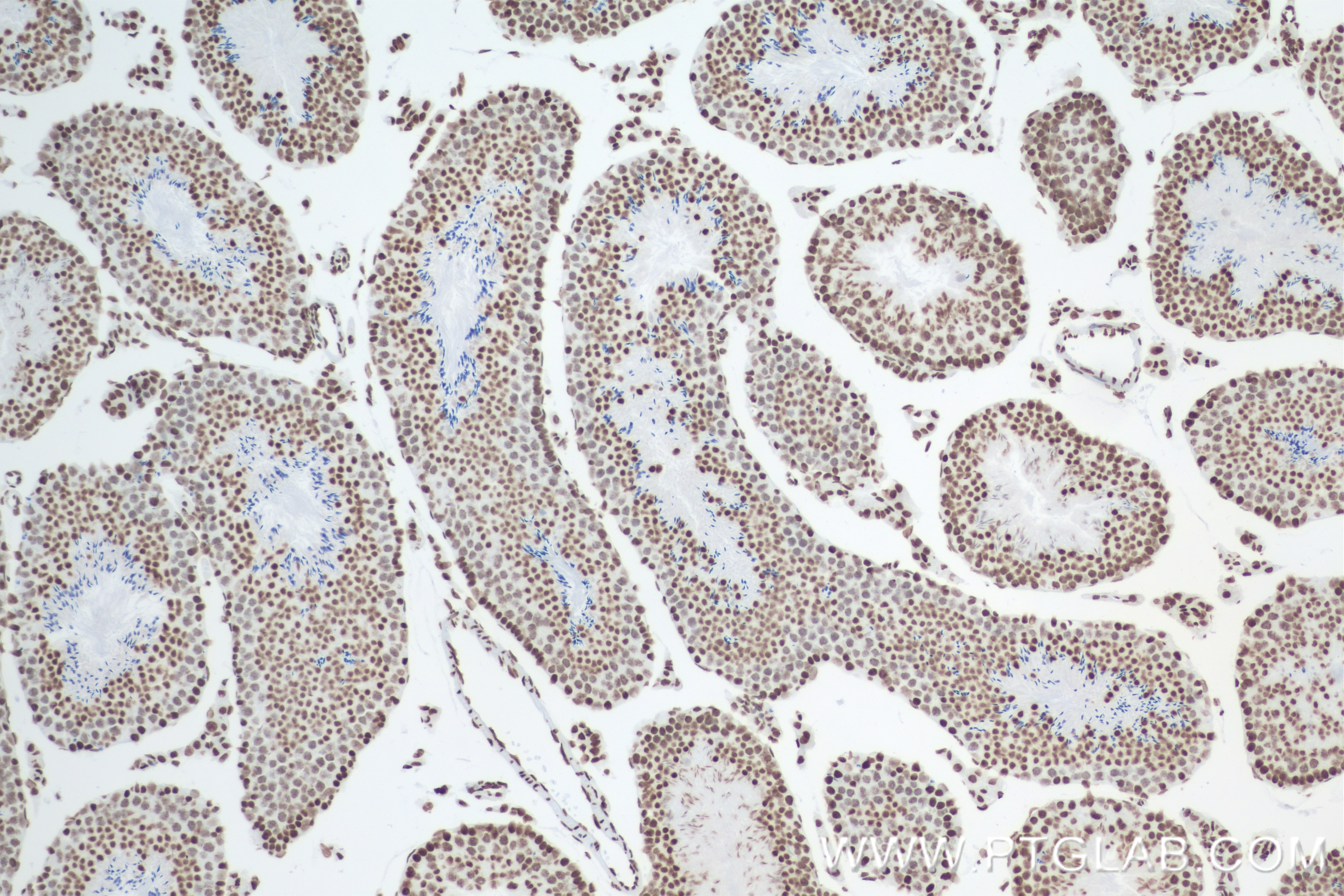 Immunohistochemistry (IHC) staining of mouse testis tissue using Mono/Di/Tri-Methyl-Histone H3 (Lys4) Recombinant a (84908-1-RR)