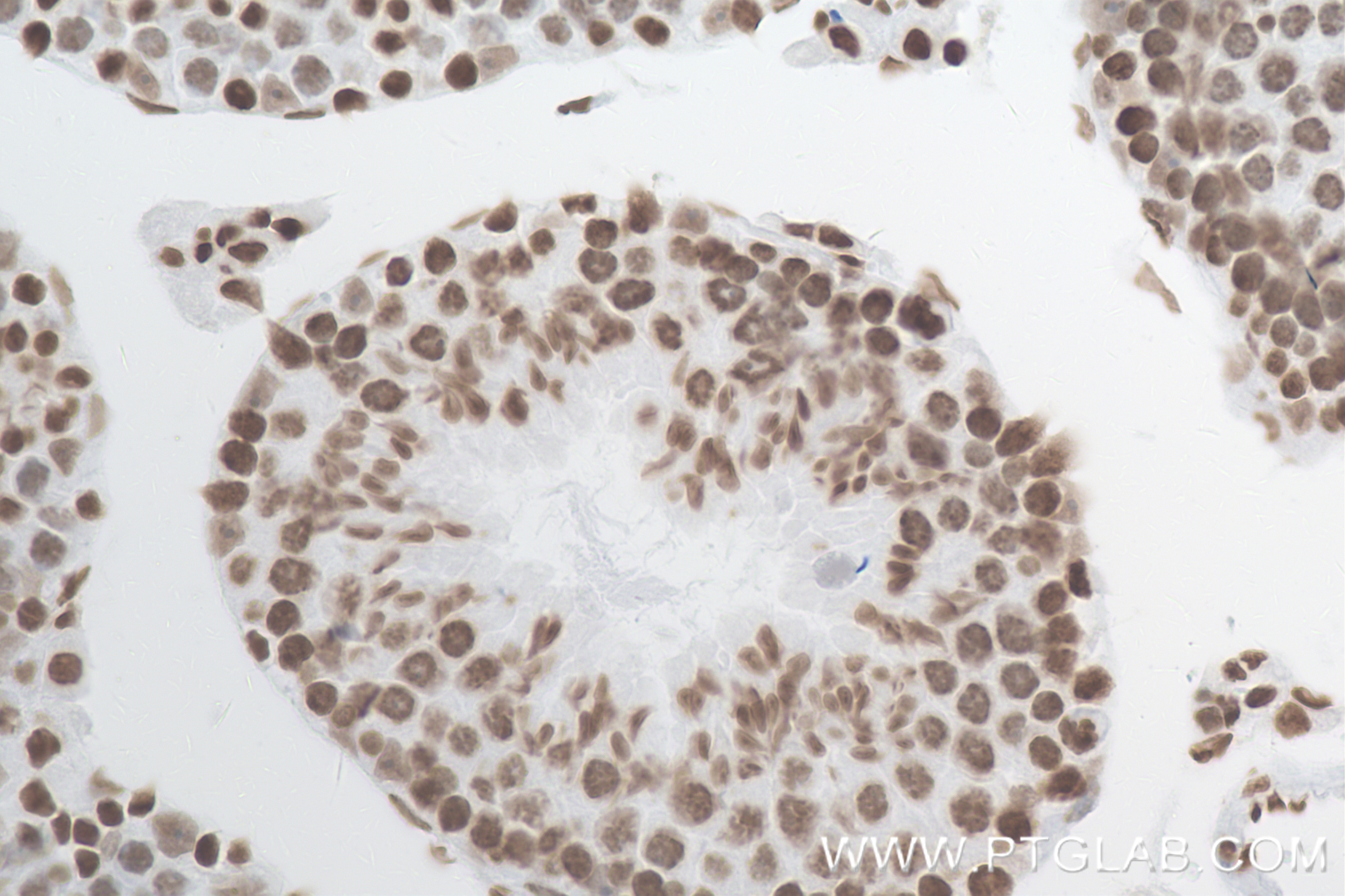 Immunohistochemistry (IHC) staining of mouse testis tissue using Mono/Di/Tri-Methyl-Histone H3 (Lys4) Recombinant a (84908-1-RR)
