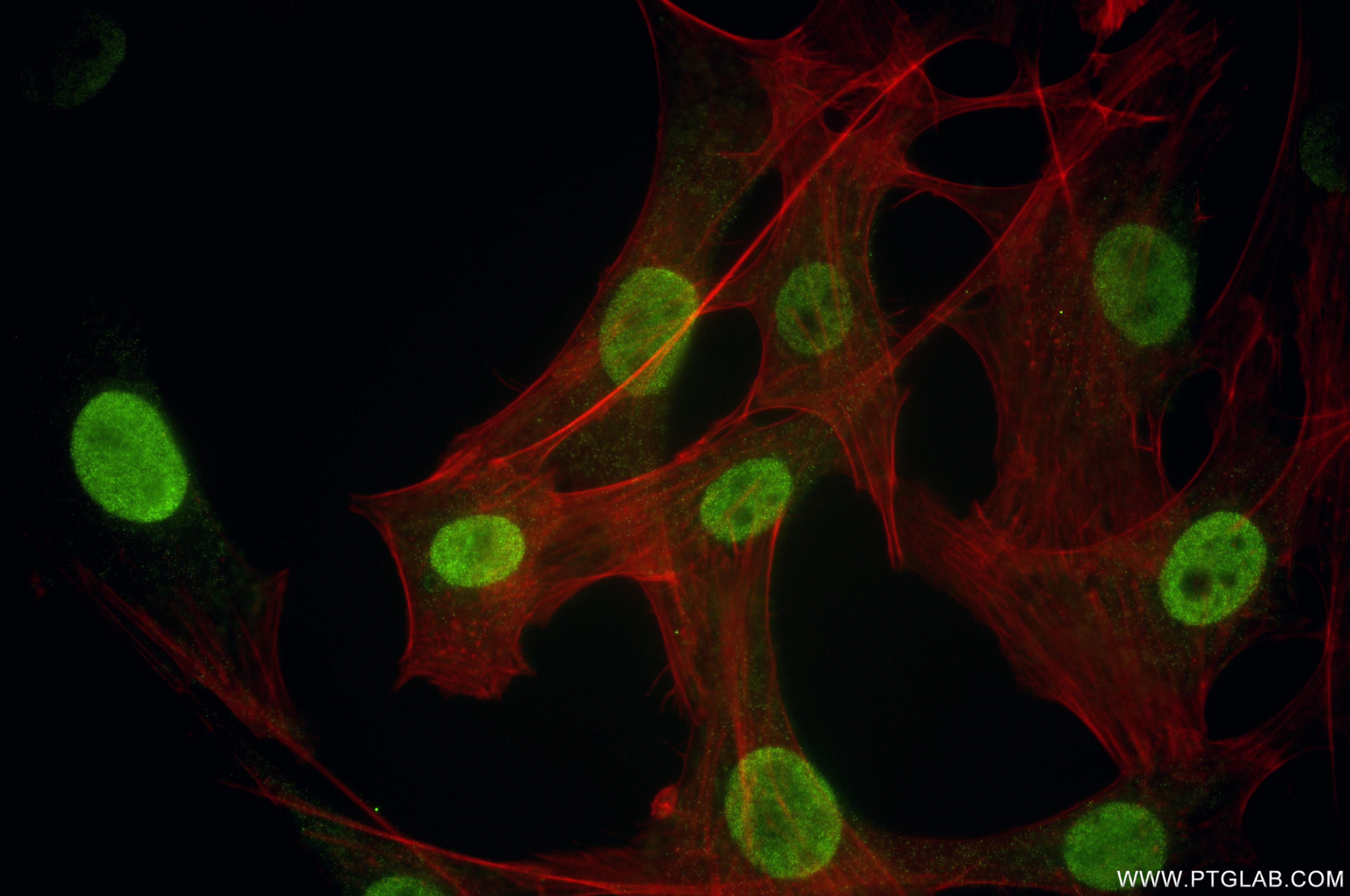 Immunofluorescence (IF) / fluorescent staining of NIH/3T3 cells using Mono-Methyl-Histone H3 (Lys23) Recombinant monoclo (86861-1-RR)