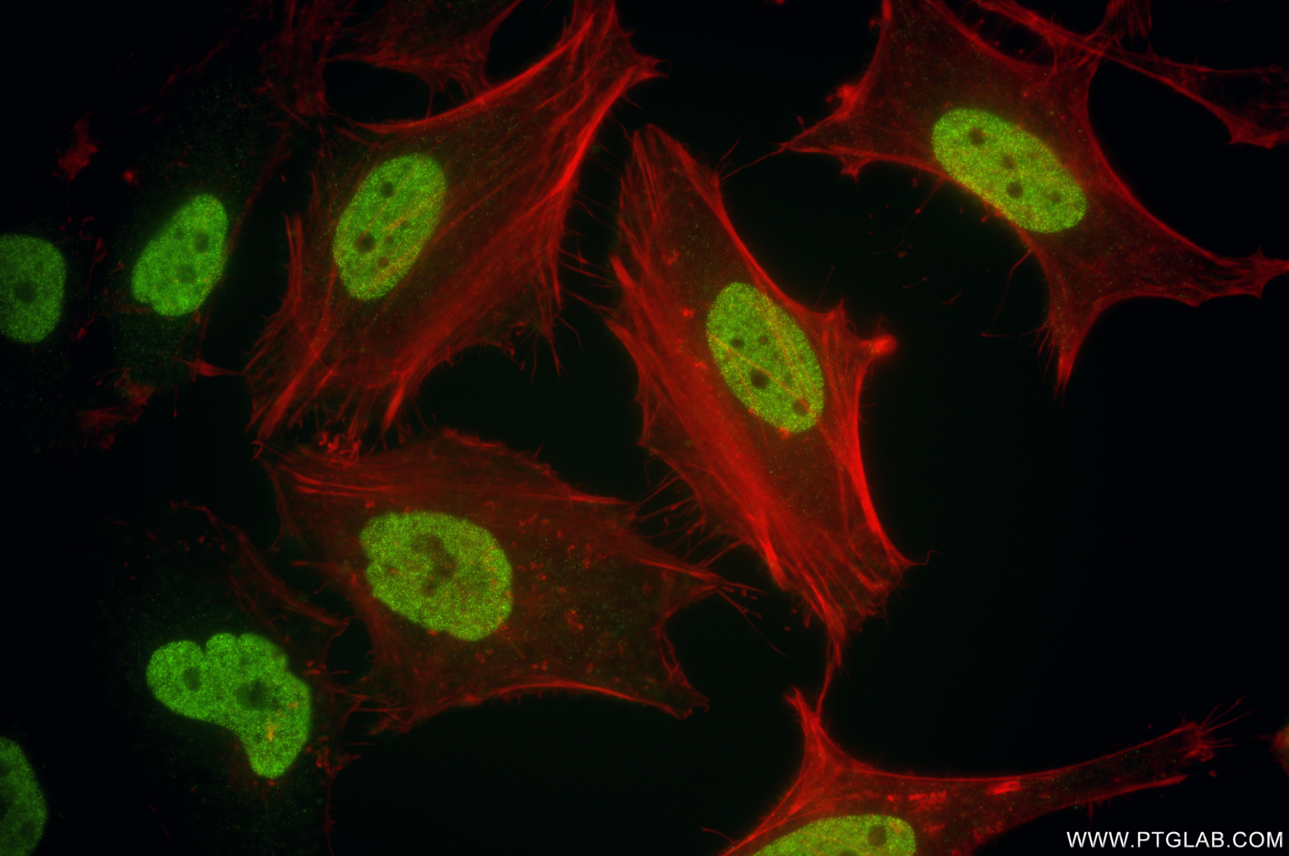Immunofluorescence (IF) / fluorescent staining of HeLa cells using Mono-Methyl-Histone H3 (Lys23) Recombinant monoclo (86861-1-RR)