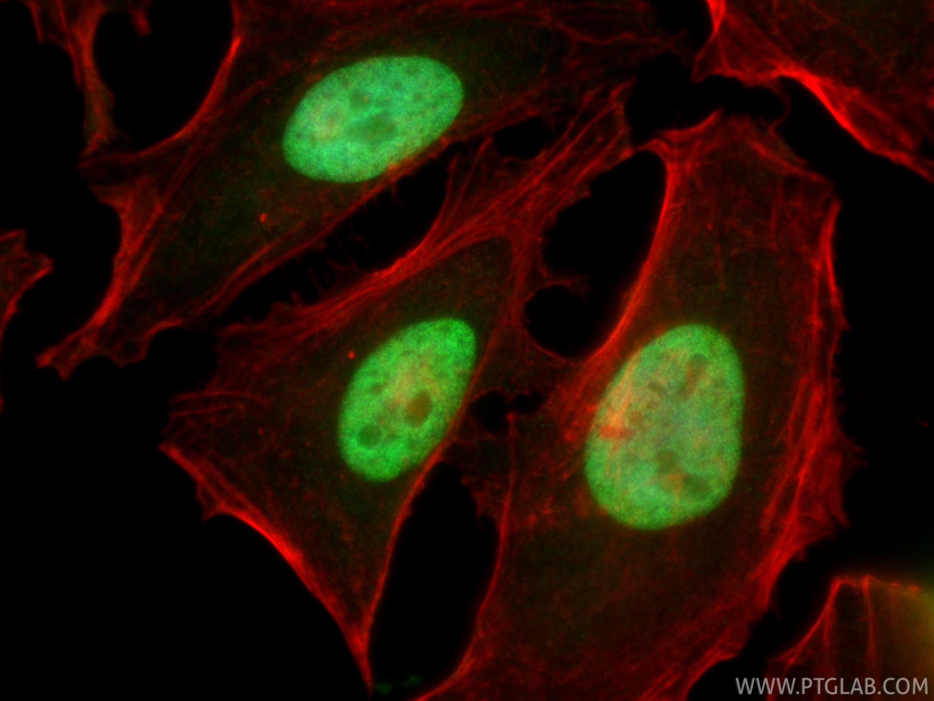 IF Staining of HeLa using 86861-1-RR Immunofluorescence (IF) / fluorescent staining of HeLa cells using Mono-Methyl-Histone H3 (Lys23) Recombinant monoclo (86861-1-RR)