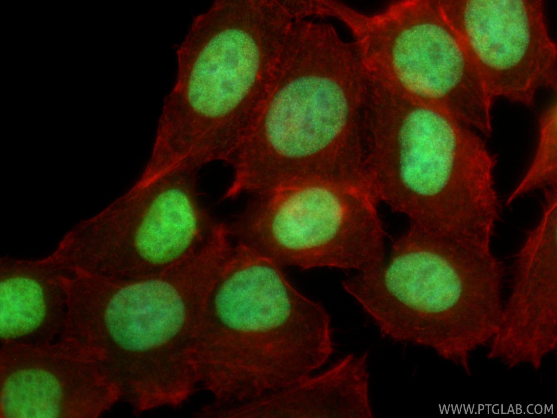 IF Staining of MCF-7 using 86861-1-RR Immunofluorescence (IF) / fluorescent staining of MCF-7 cells using Mono-Methyl-Histone H3 (Lys23) Recombinant monoclo (86861-1-RR)