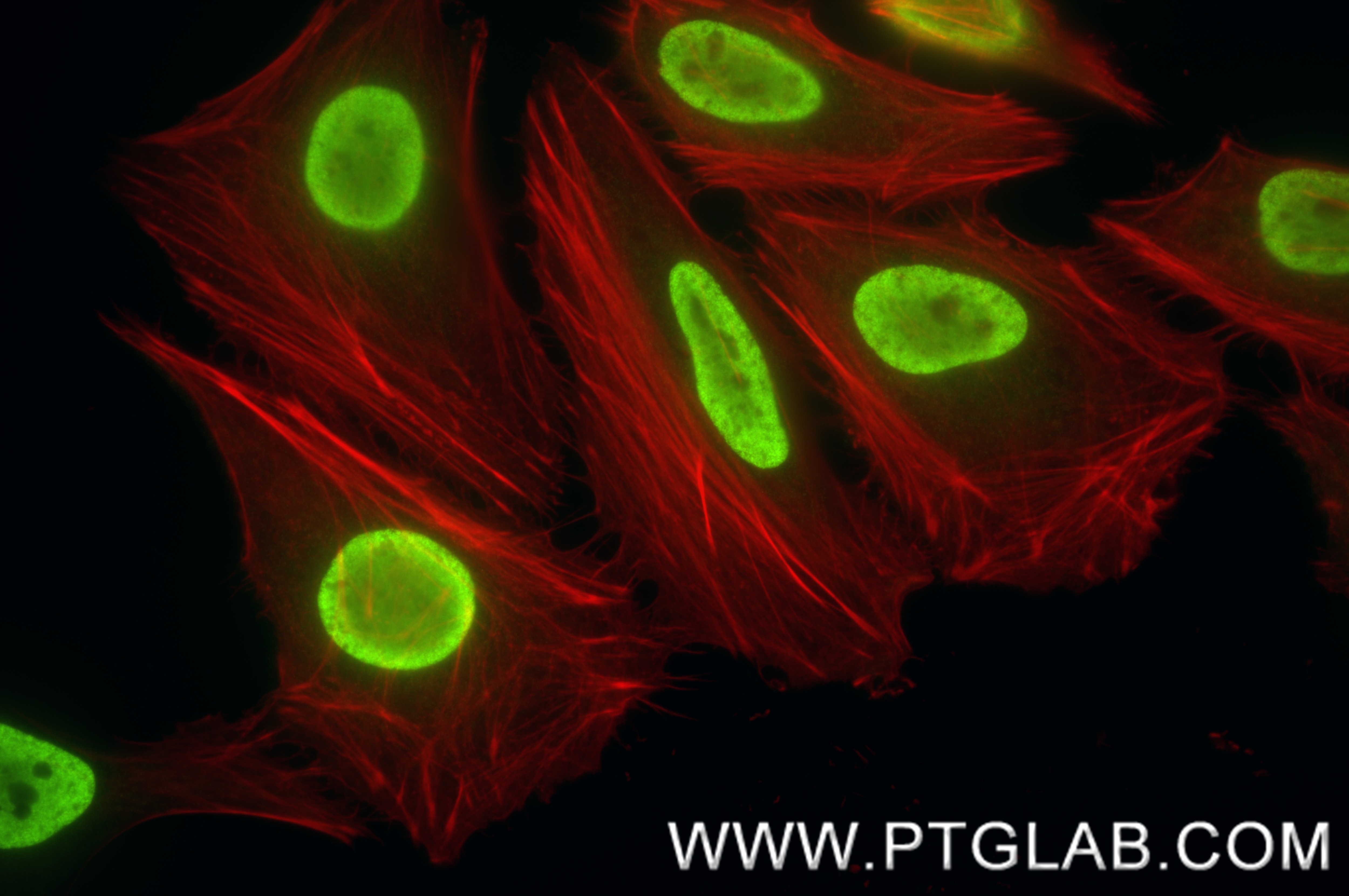 Immunofluorescence (IF) / fluorescent staining of HeLa cells using Mono-Methyl-Histone H3 (Lys4) Recombinant antibody (84740-1-RR)