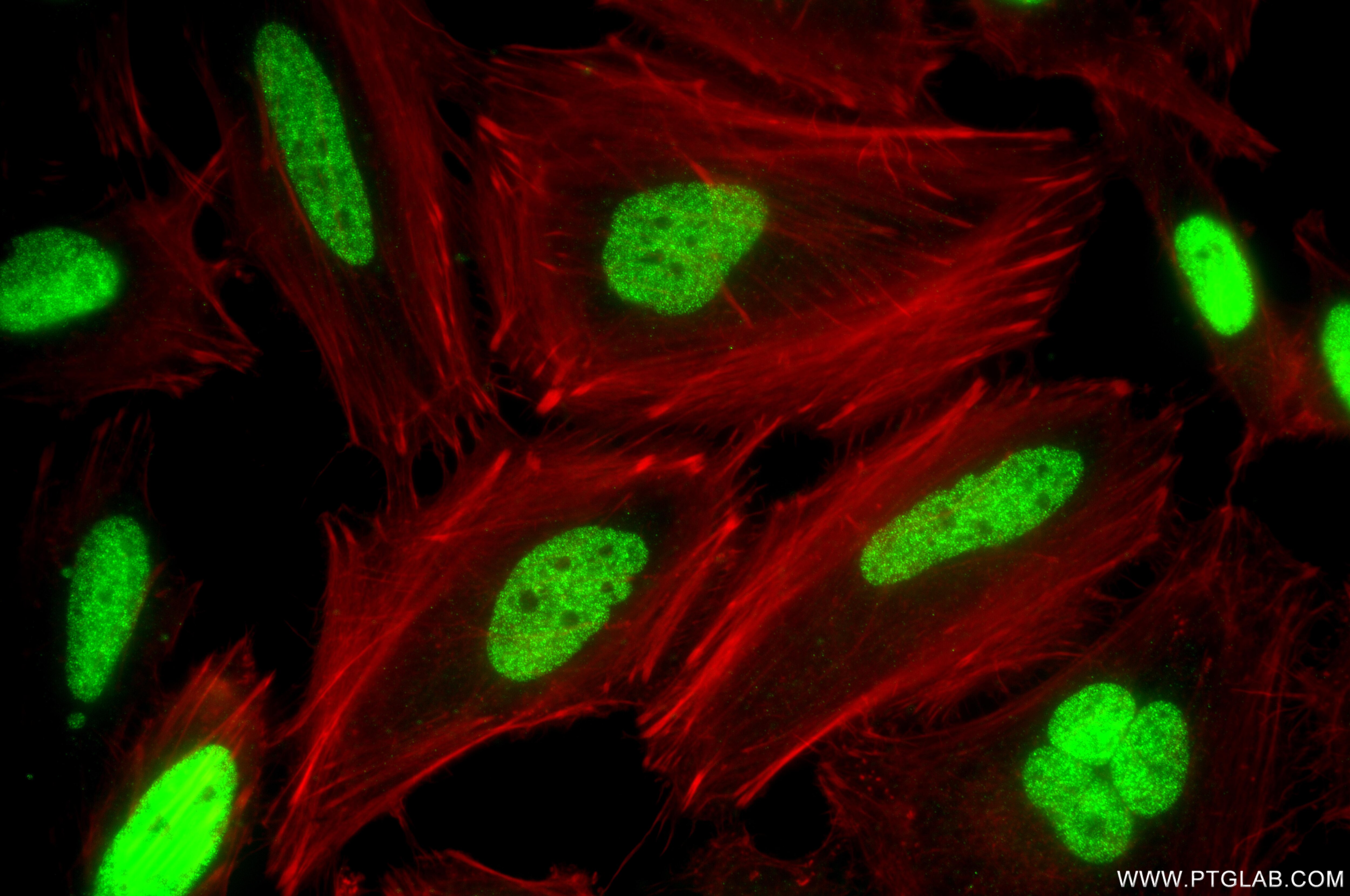 IF Staining of HeLa using 87727-1-RR Immunofluorescence (IF) / fluorescent staining of HeLa cells using Mono-Methyl-Histone H3 (Lys56) Recombinant monoclo (87727-1-RR)