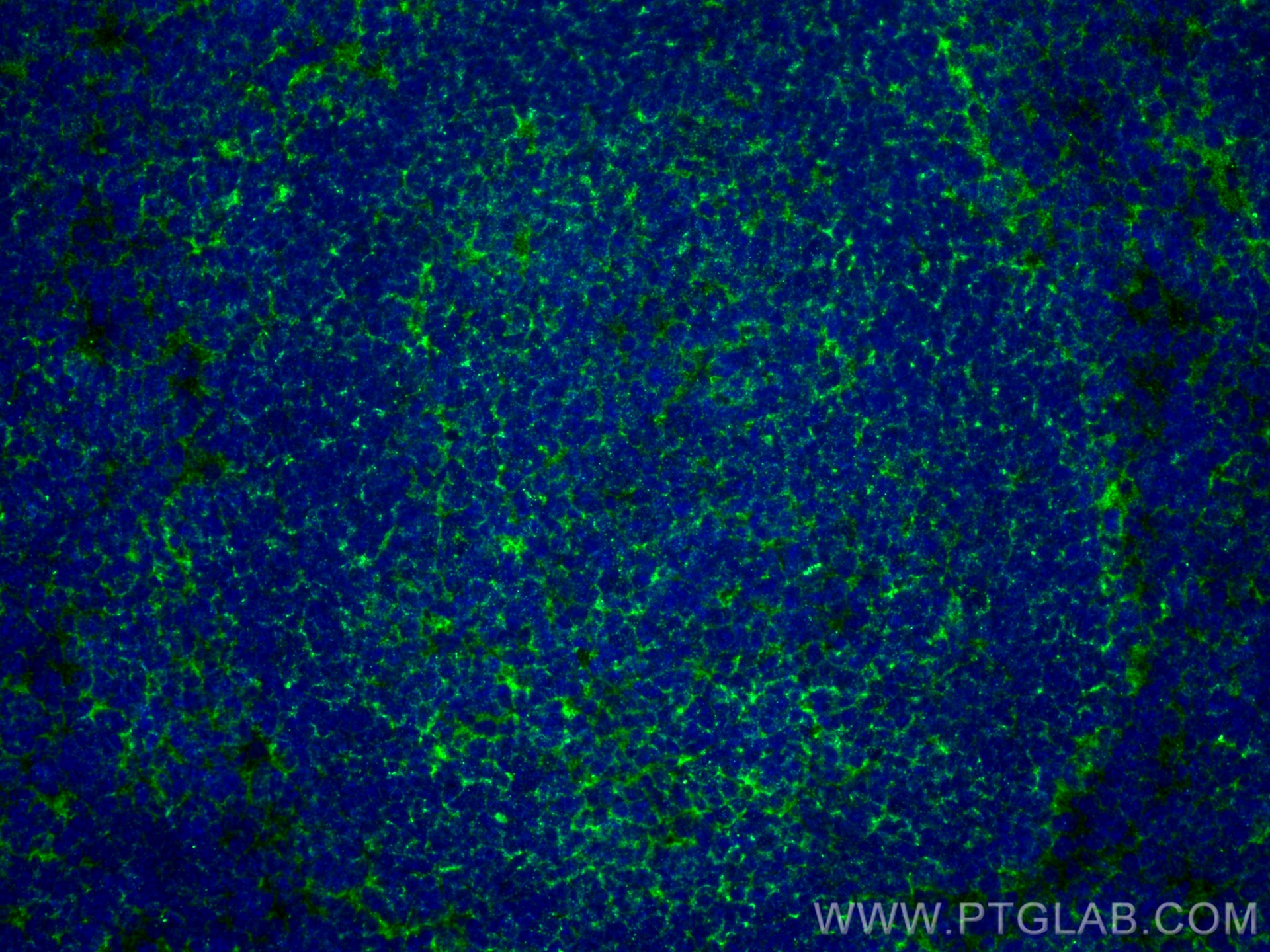 Immunofluorescence (IF) / fluorescent staining of mouse spleen tissue using CD45.1 Recombinant antibody (84325-1-RR)