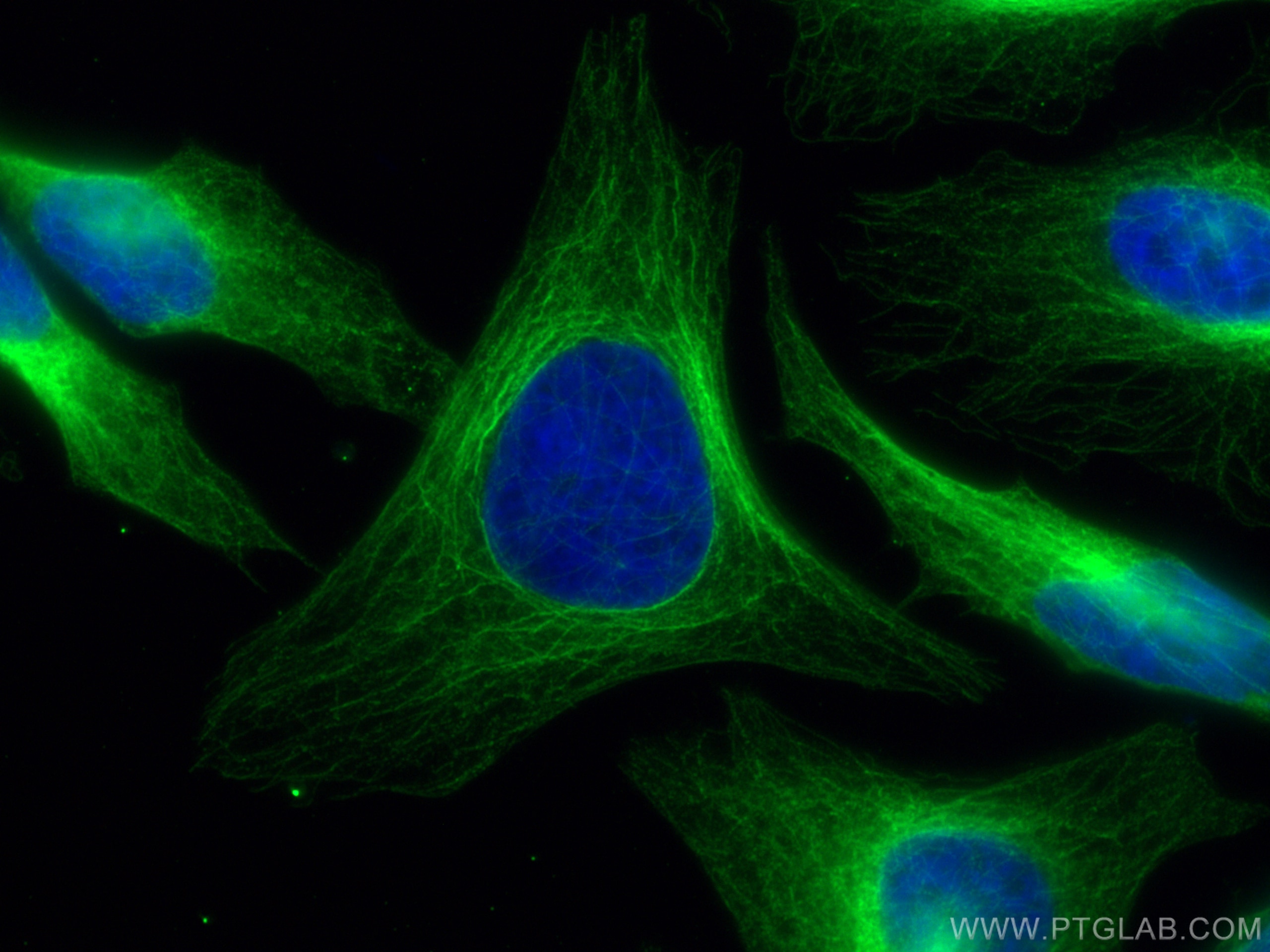 Immunofluorescence (IF) / fluorescent staining of HeLa cells using CoraLite® Plus 488-conjugated Mouse-IgG Polyclonal (CL488-10283)