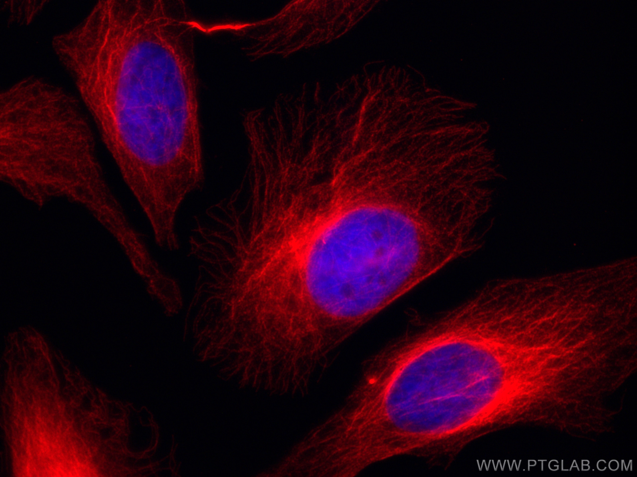 Immunofluorescence (IF) / fluorescent staining of HeLa cells using CoraLite®594-conjugated Mouse-IgG Polyclonal antib (CL594-10283)