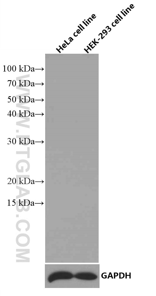 Western Blot (WB) analysis of various lysates using Mouse IgG1 isotype control Monoclonal antibody (66360-1-Ig)