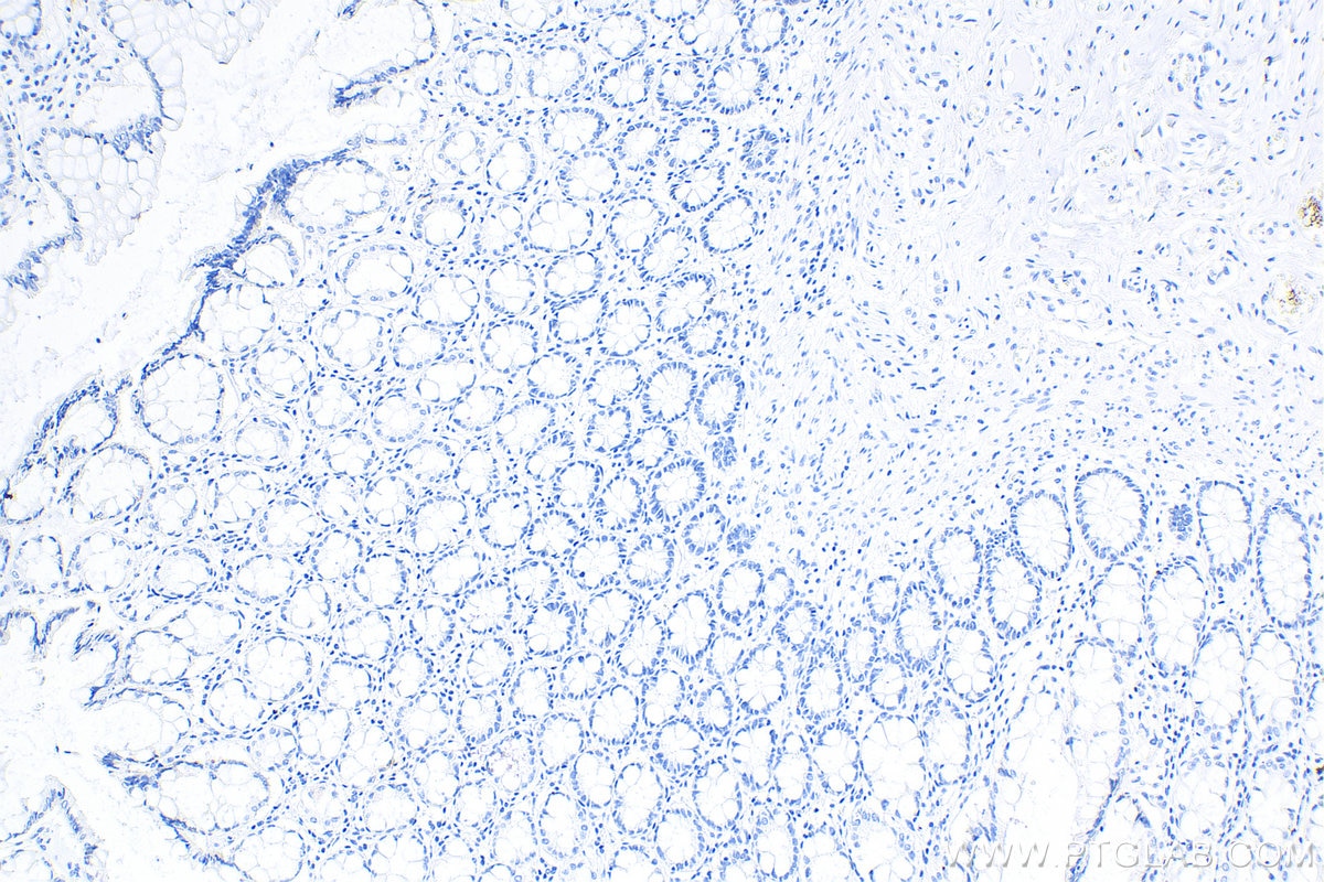 Immunohistochemistry (IHC) staining of human colon tissue using Mouse IgG2b isotype control Monoclonal antibody (66360-3-Ig)