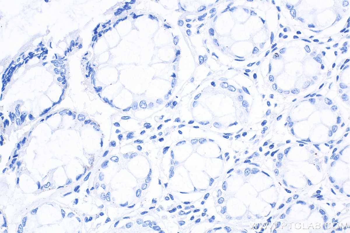 Immunohistochemistry (IHC) staining of human colon tissue using Mouse IgG2b isotype control Monoclonal antibody (66360-3-Ig)