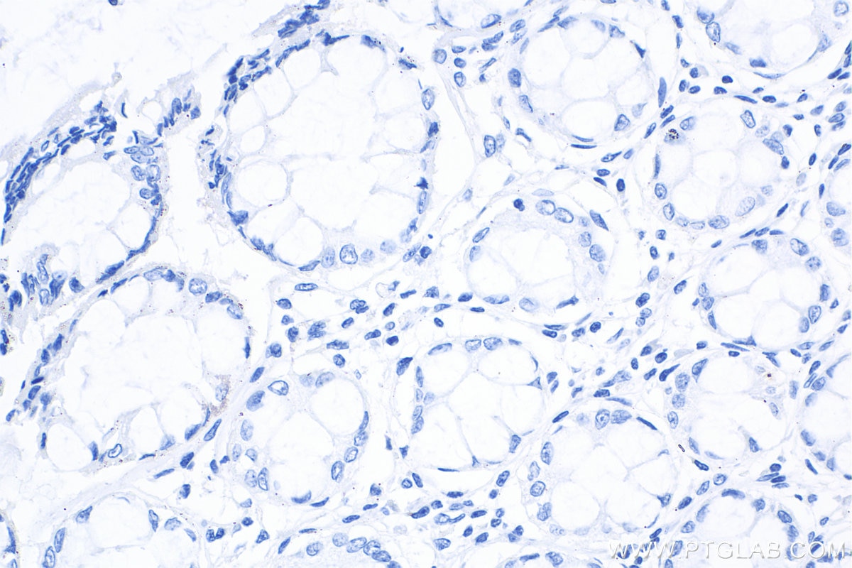 IHC staining of human colon using 66360-3-Ig