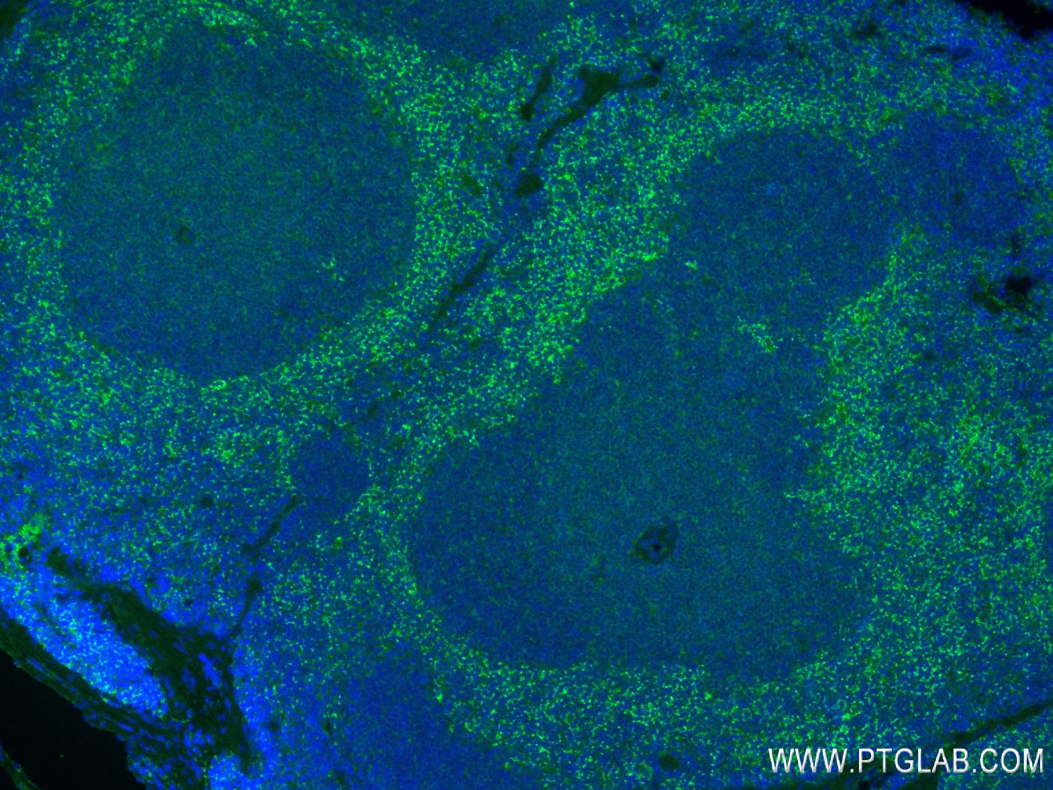 Immunofluorescence (IF) / fluorescent staining of mouse spleen tissue using MPO Recombinant antibody (84436-4-RR)