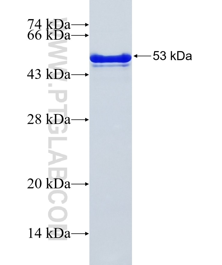 Multi tags fusion protein Ag21457 SDS-PAGE