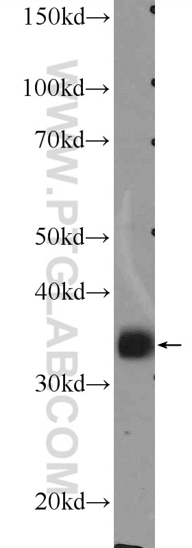 Western Blot (WB) analysis of MCF-7 cells using MSI2 Polyclonal antibody (10770-1-AP)
