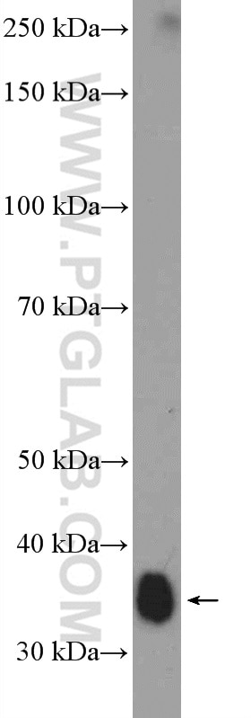 WB analysis of MCF-7 using 10770-1-AP