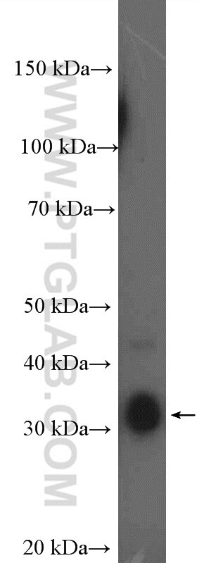 Western Blot (WB) analysis of MCF-7 cells using MSI2 Polyclonal antibody (10770-1-AP)