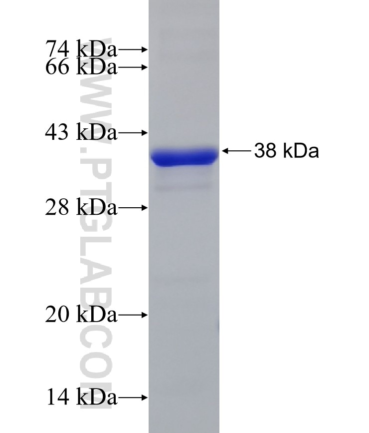 Musashi-2 fusion protein Ag23426 SDS-PAGE