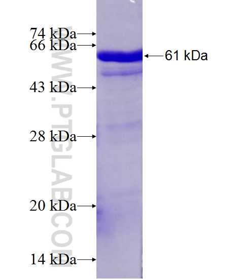 Musashi-2 fusion protein Ag1213 SDS-PAGE