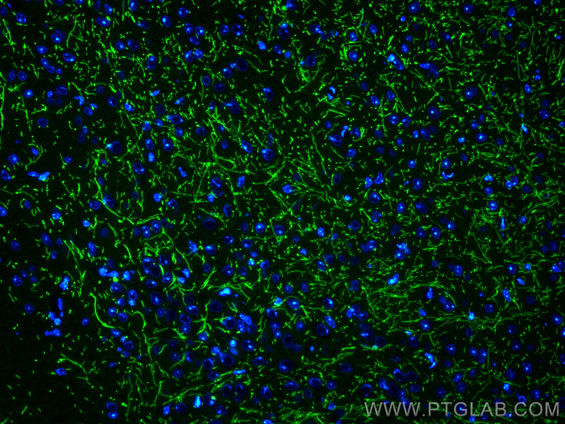 Immunofluorescence (IF) / fluorescent staining of mouse brain tissue using CoraLite® Plus 488-conjugated Myelin basic protein (CL488-10458)