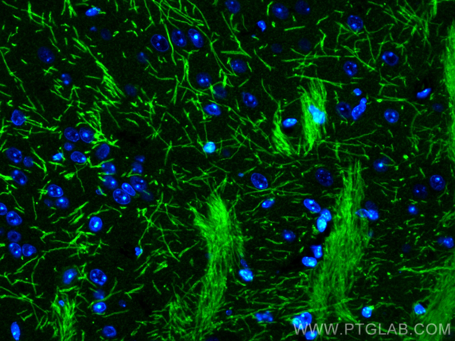 Immunofluorescence (IF) / fluorescent staining of mouse brain tissue using CoraLite® Plus 488-conjugated Myelin basic protein (CL488-10458)