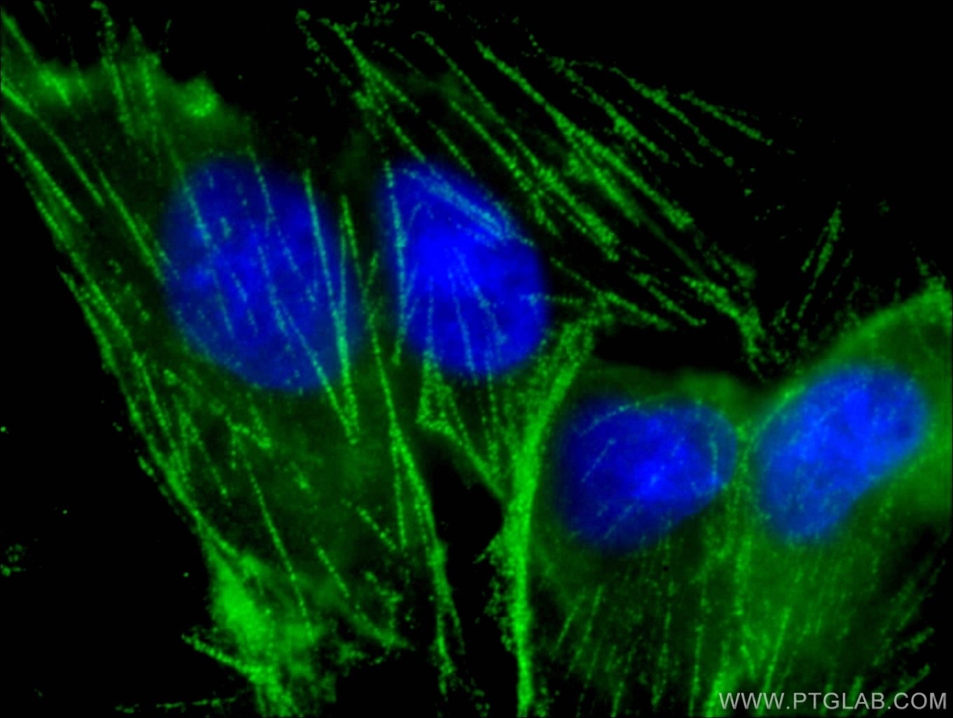 Immunofluorescence (IF) / fluorescent staining of MDCK cells using Myh9 Polyclonal antibody (14844-1-AP)