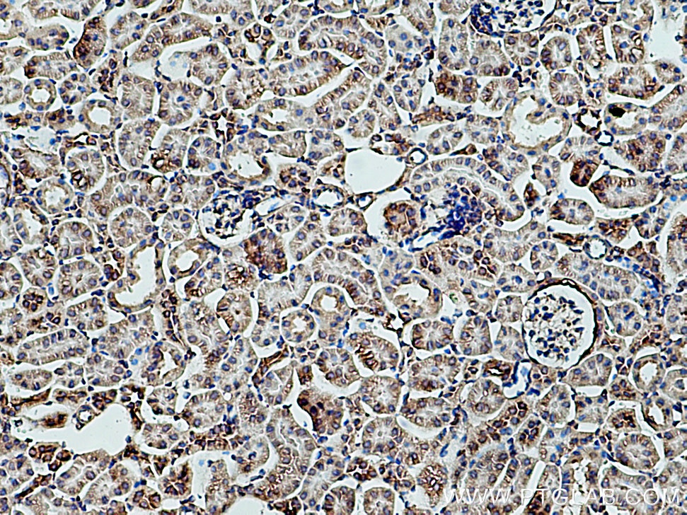 Immunohistochemistry (IHC) staining of mouse kidney tissue using Myh9 Polyclonal antibody (14844-1-AP)