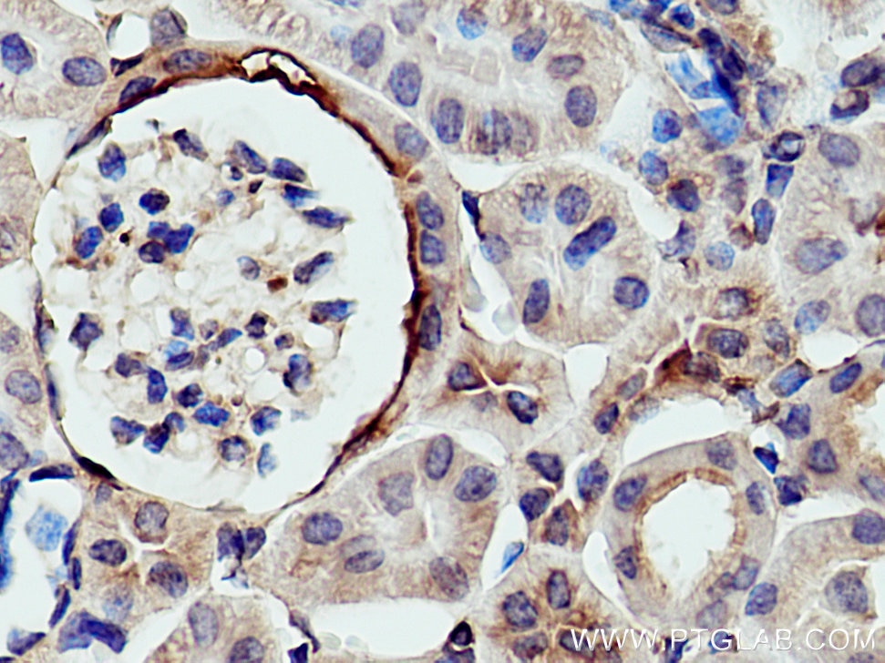 Immunohistochemistry (IHC) staining of mouse kidney tissue using Myh9 Polyclonal antibody (14844-1-AP)