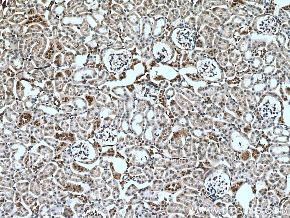 Immunohistochemistry (IHC) staining of mouse kidney tissue using Myh9 Polyclonal antibody (51053-1-Ig)