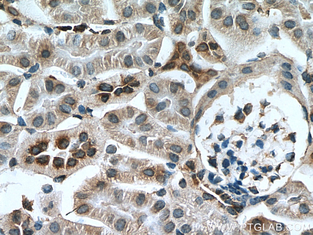 Immunohistochemistry (IHC) staining of mouse kidney tissue using Myh9 Polyclonal antibody (51053-1-Ig)