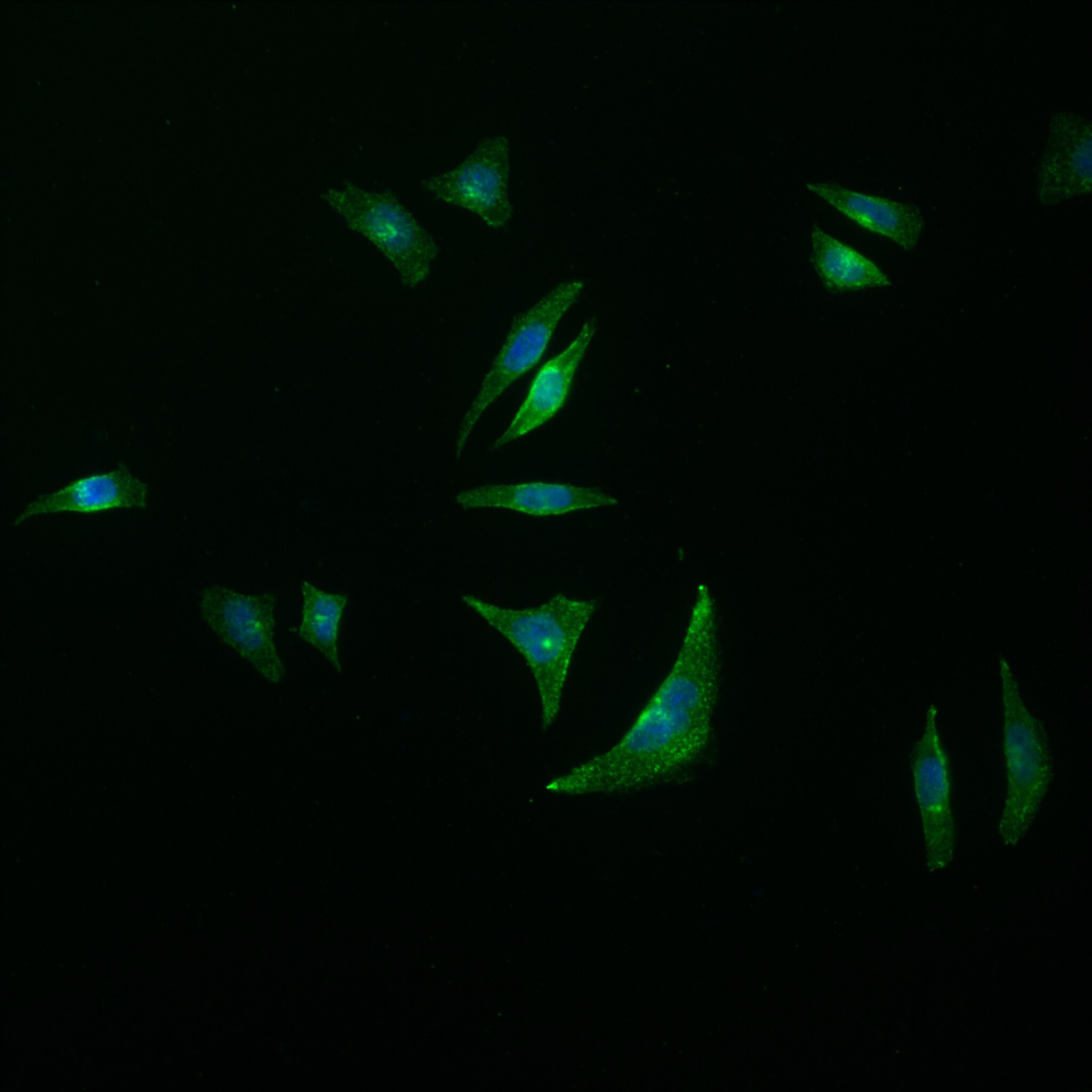 Immunofluorescence (IF) / fluorescent staining of HepG2 cells using MYOF Recombinant antibody (82917-2-RR)