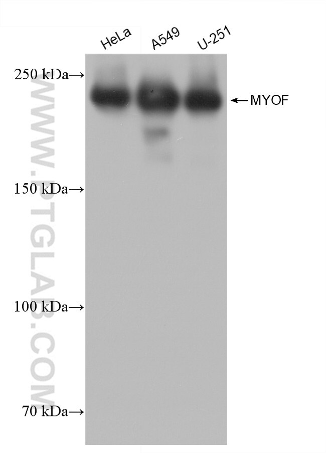 Western Blot (WB) analysis of various lysates using MYOF Recombinant antibody (82917-2-RR)