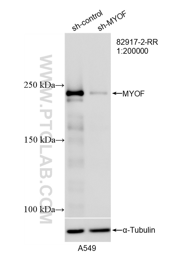 WB result of MYOF antibody (82917-2-RR; 1:200000; incubated at room temperature for 1.5 hours) with sh-Control and sh-MYOF transfected A549 cells. Western Blot (WB) analysis of A549 cells using MYOF Recombinant antibody (82917-2-RR)