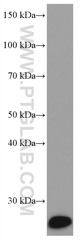 Western Blot (WB) analysis of human skeletal muscle tissue using Myogenin Monoclonal antibody (67082-1-Ig)