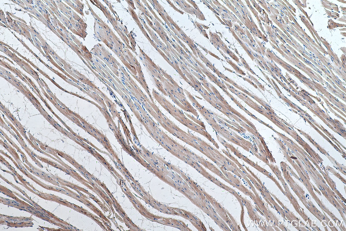 IHC staining of rat heart using 66205-1-Ig