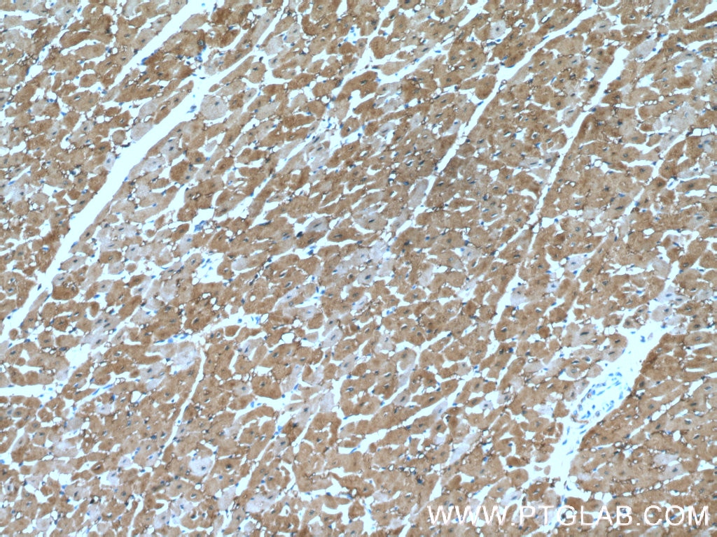 Immunohistochemistry (IHC) staining of human heart tissue using Myoglobin Monoclonal antibody (66205-1-Ig)