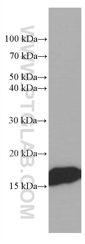 Western Blot (WB) analysis of human skeletal muscle tissue using Myoglobin Monoclonal antibody (66205-1-Ig)