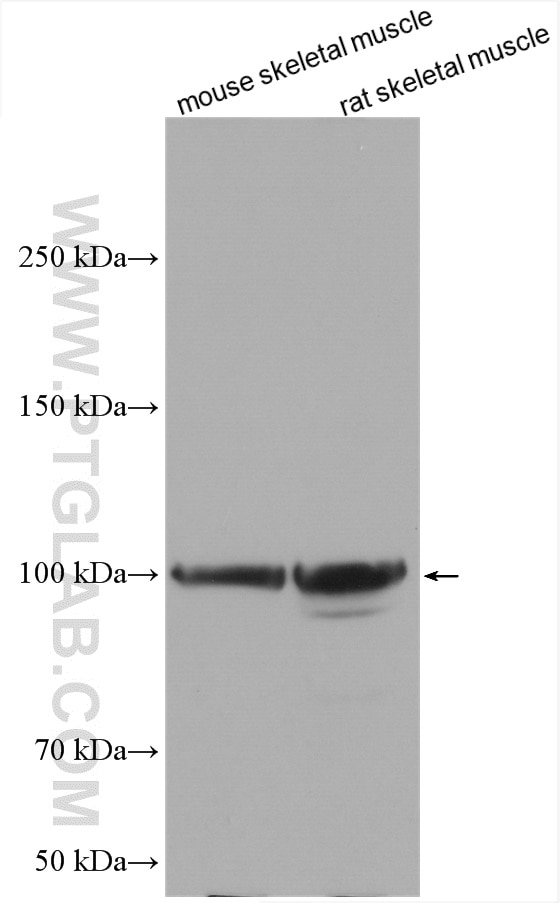 Western Blot (WB) analysis of various lysates using Myopodin Polyclonal antibody (25453-1-AP)