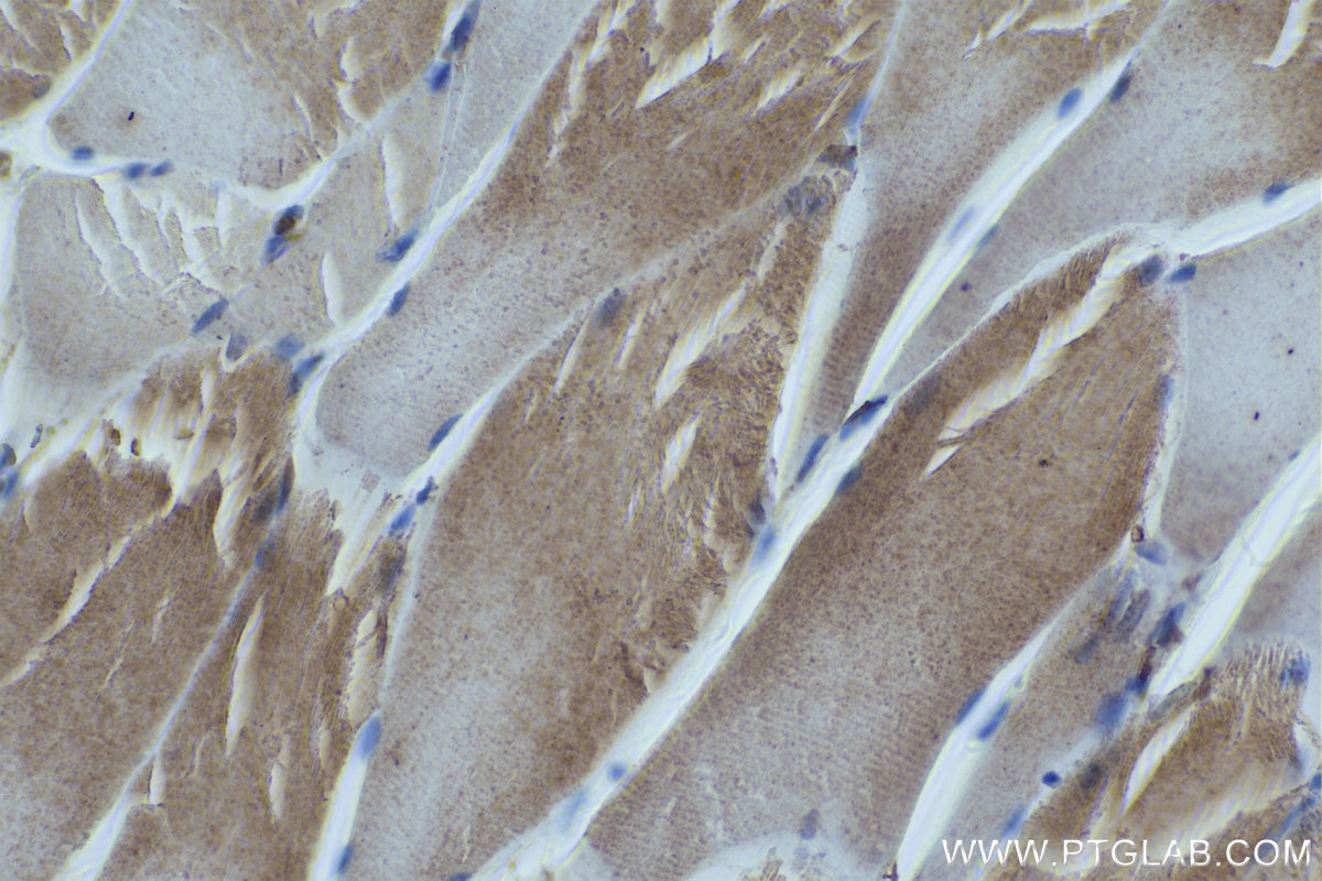 Immunohistochemistry (IHC) staining of rat skeletal muscle tissue using MYH2-specific Monoclonal antibody (66212-1-Ig)