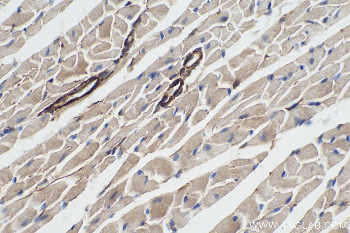 Immunohistochemistry (IHC) staining of mouse heart tissue using MYH2-specific Monoclonal antibody (66212-1-Ig)