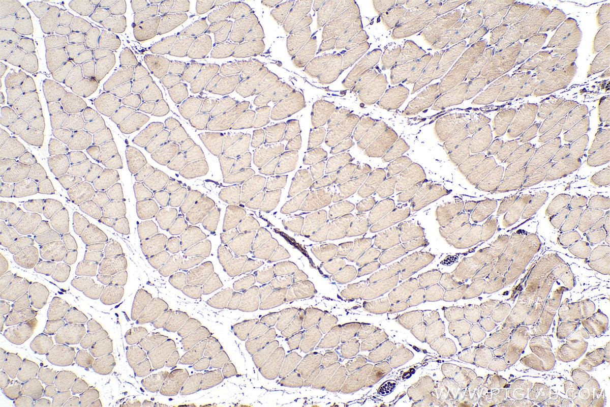 IHC staining of mouse skeletal muscle using 66212-1-Ig