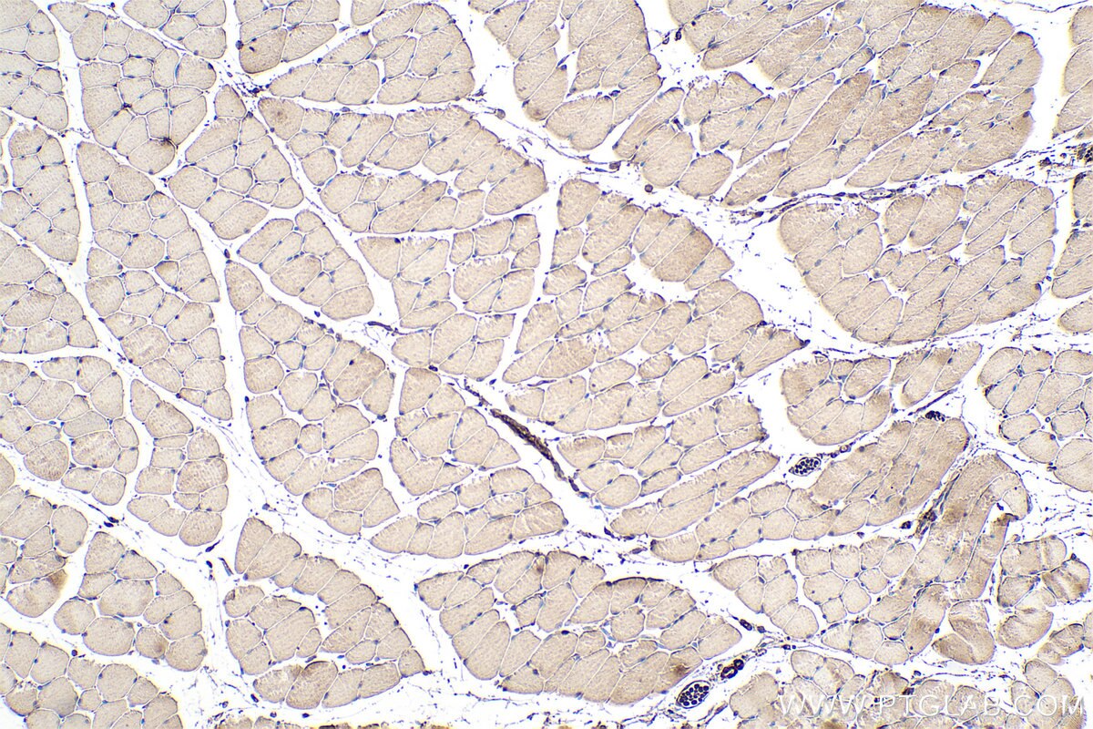 Immunohistochemistry (IHC) staining of mouse skeletal muscle tissue using MYH2-specific Monoclonal antibody (66212-1-Ig)