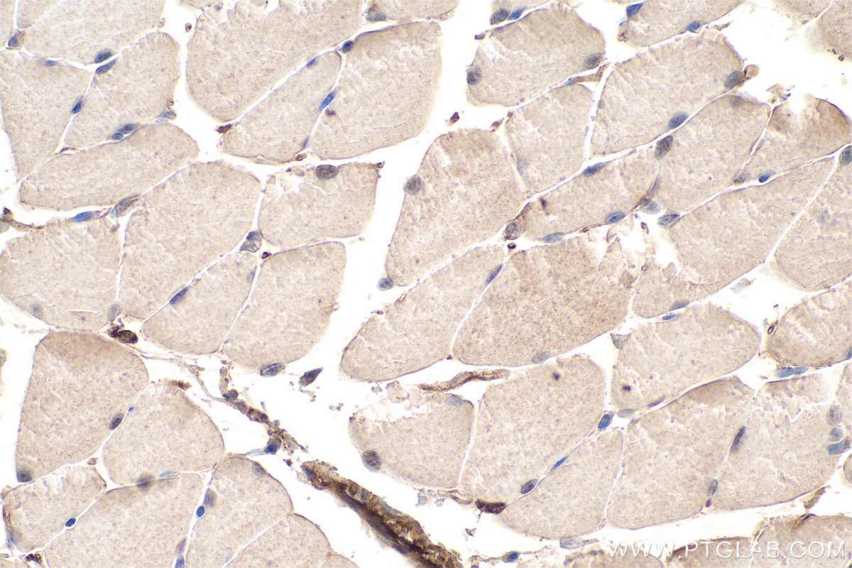 Immunohistochemistry (IHC) staining of mouse skeletal muscle tissue using MYH2-specific Monoclonal antibody (66212-1-Ig)