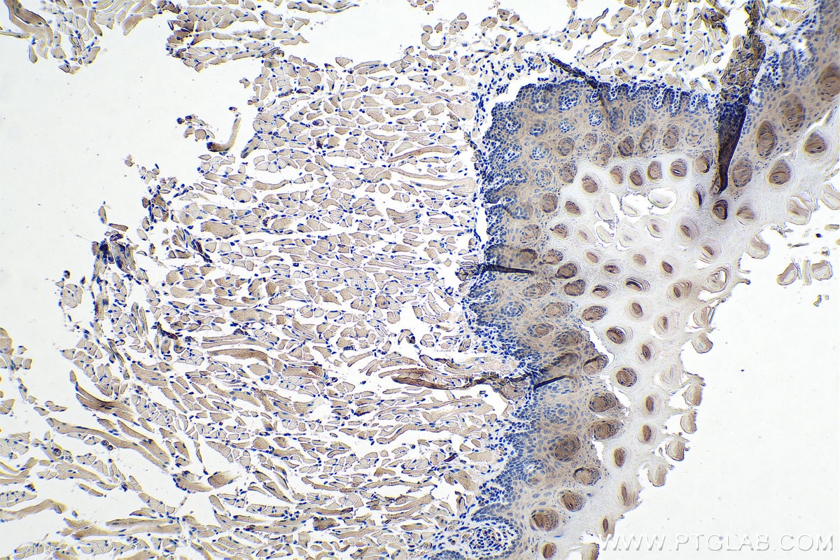 Immunohistochemistry (IHC) staining of mouse tongue tissue using MYH2-specific Monoclonal antibody (66212-1-Ig)