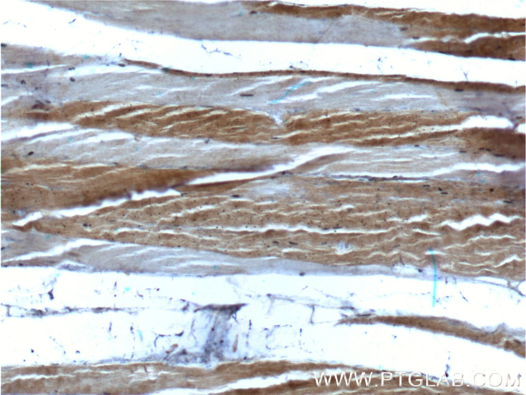 IHC staining of human skeletal muscle using 66212-1-Ig