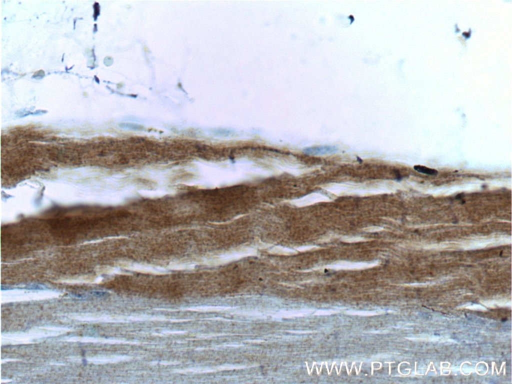 Immunohistochemistry (IHC) staining of human skeletal muscle tissue using MYH2-specific Monoclonal antibody (66212-1-Ig)