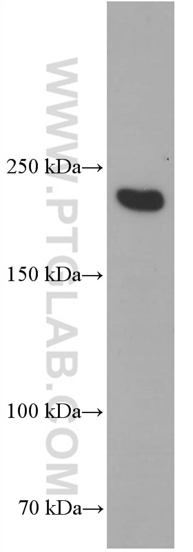 Western Blot (WB) analysis of human skeletal muscle tissue using MYH2-specific Monoclonal antibody (66212-1-Ig)