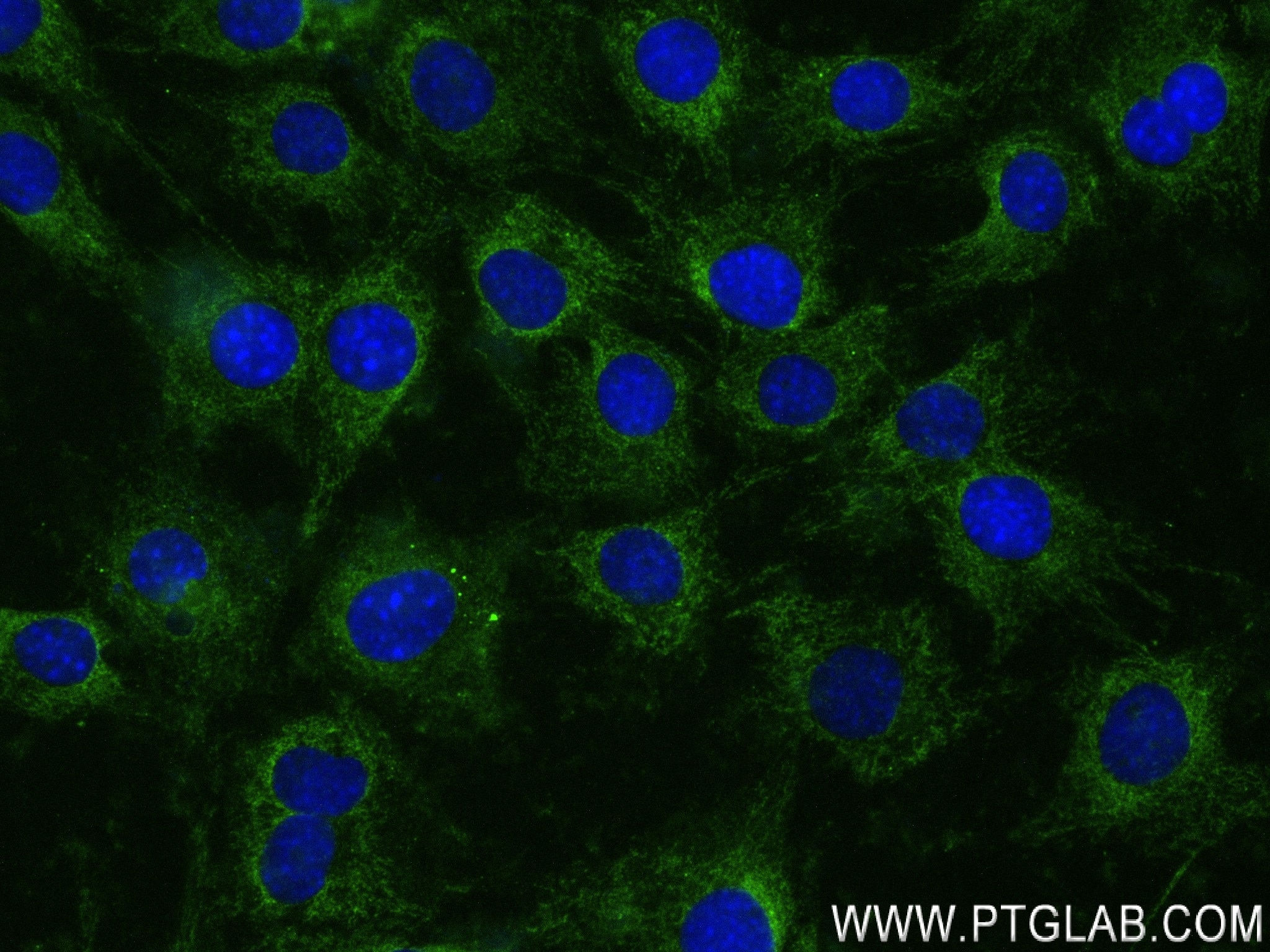 Immunofluorescence (IF) / fluorescent staining of C2C12 cells using MYH2-specific Recombinant antibody (84099-1-RR)