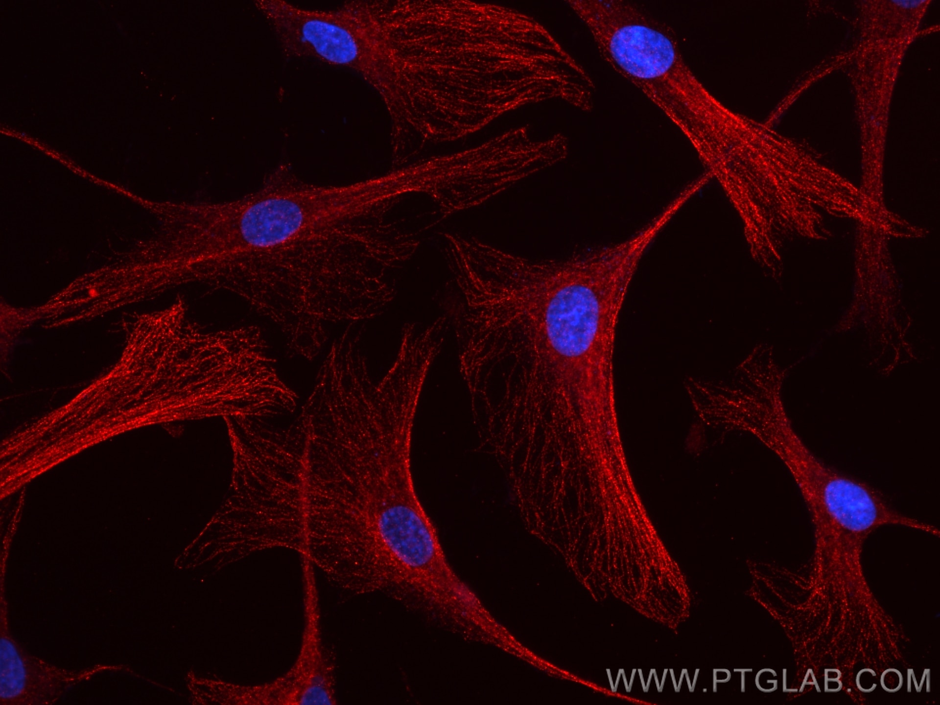 Immunofluorescence (IF) / fluorescent staining of HSkMC cells using MYH2-specific Recombinant antibody (84099-1-RR)