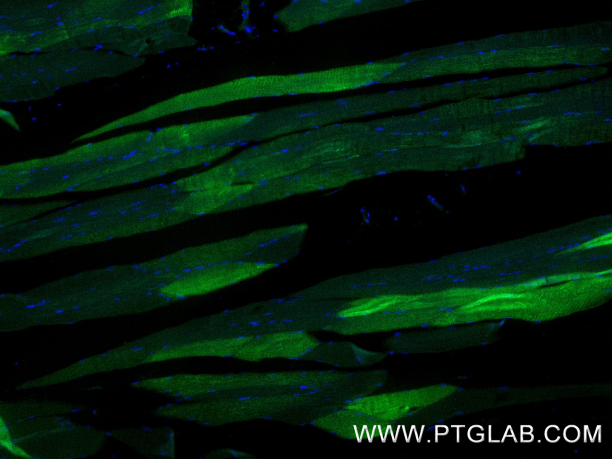 IF Staining of human skeletal muscle using 84099-1-RR Immunofluorescence (IF) / fluorescent staining of human skeletal muscle tissue using MYH2-specific Recombinant monoclonal antibody (84099-1-RR)